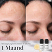 Medik8 Oxy-R Peptides 2x 10ml resultado antes y después