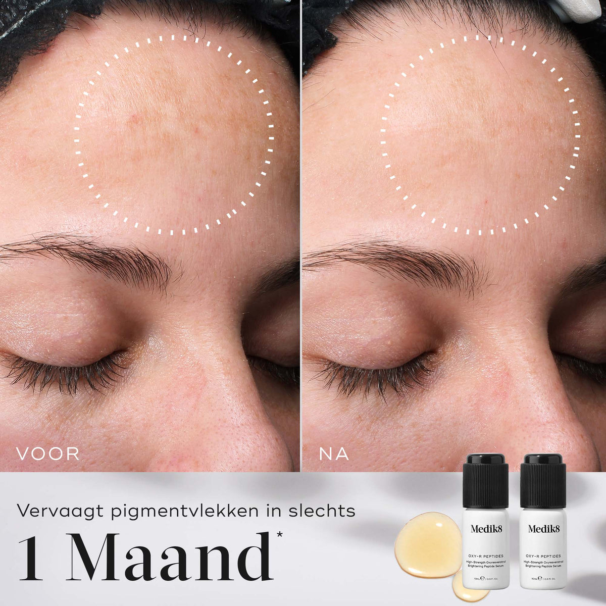 Medik8 Oxy-R Peptides 2x 10ml resultado antes y después
