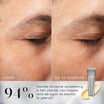Medik8 Crystal Retinal Ceramide Eye 3 15ml resultado antes y después