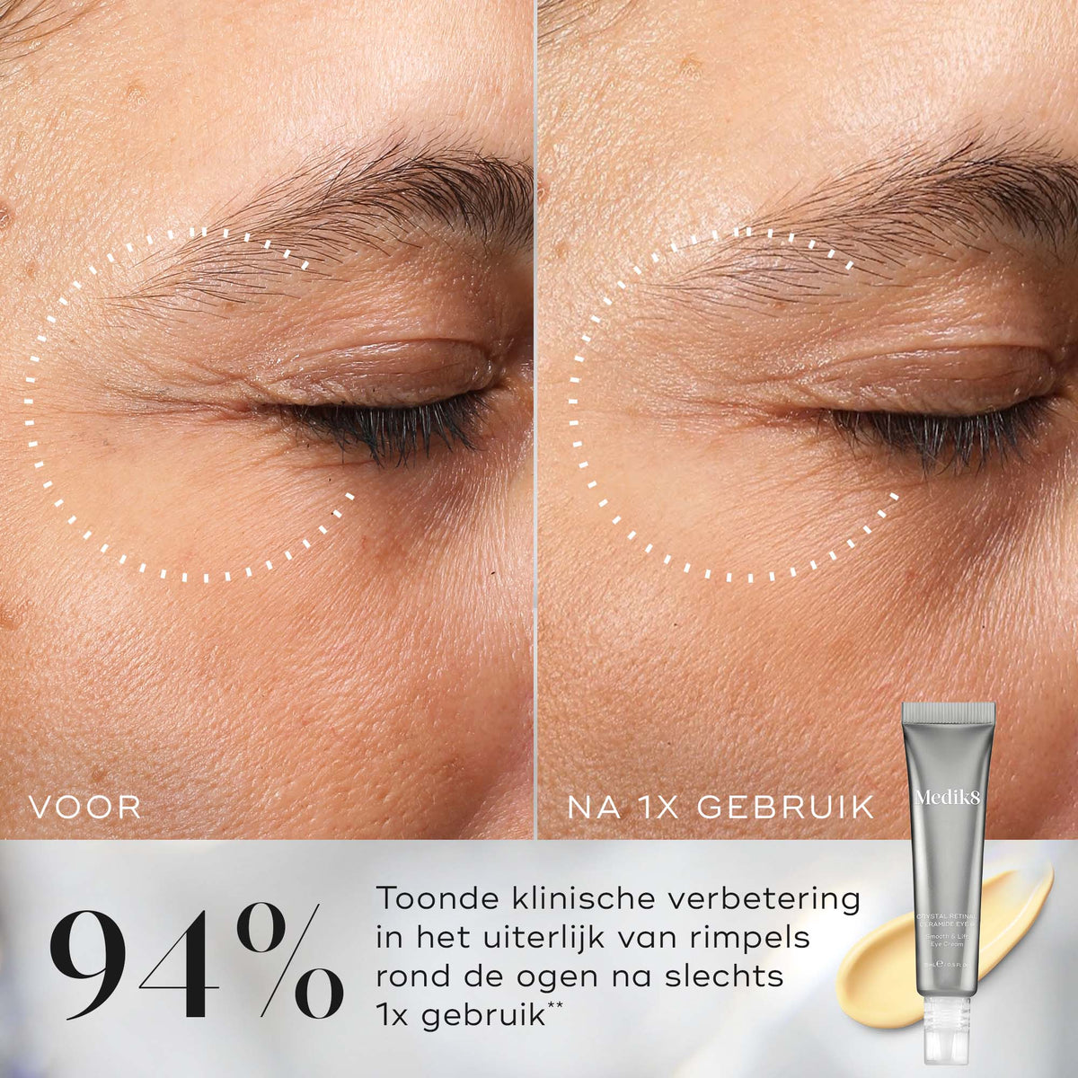Medik8 Crystal Retinal Ceramide Eye 3 15ml resultado antes y después