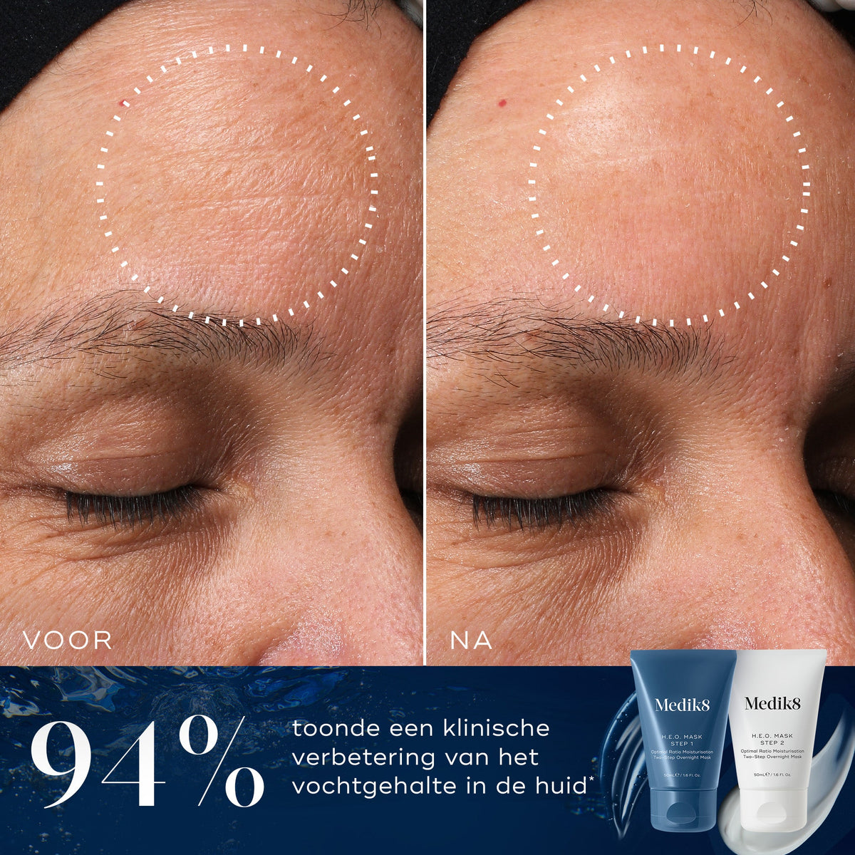 Medik8 H.E.O. Mask 2x 50ml resultado antes y después