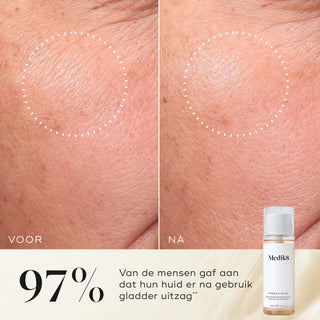 Medik8 Press & Glow Refill 200ml resultado antes y después