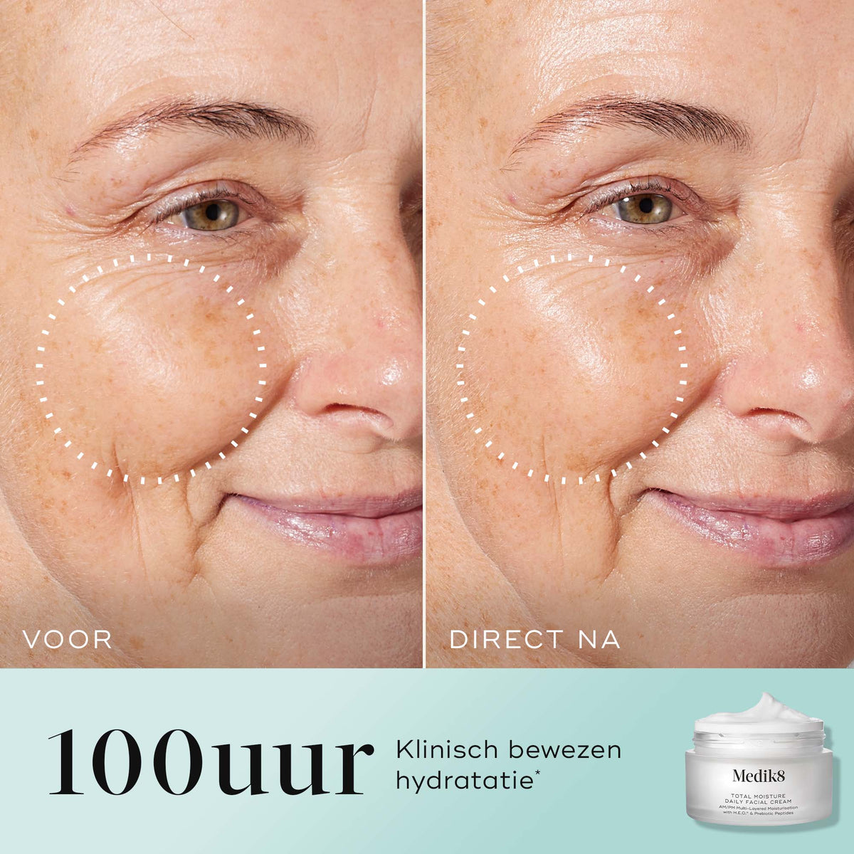 Medik8 Total Moisture Daily Facial Cream 50ml resultado antes y después