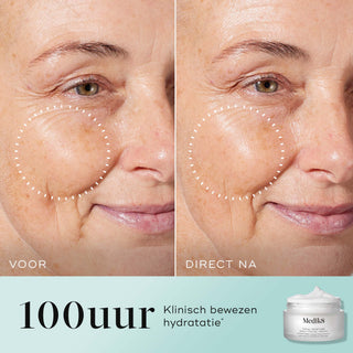 Medik8 Total Moisture Daily Facial Cream - Refill 50ml resultado antes y después