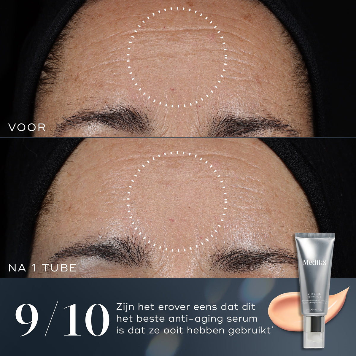 Medik8 Crystal Retinal 10 30ml resultado antes y después dos