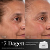Medik8 Advanced Pro Collagen+ Peptide Cream REFILL 50ml resultado antes y después