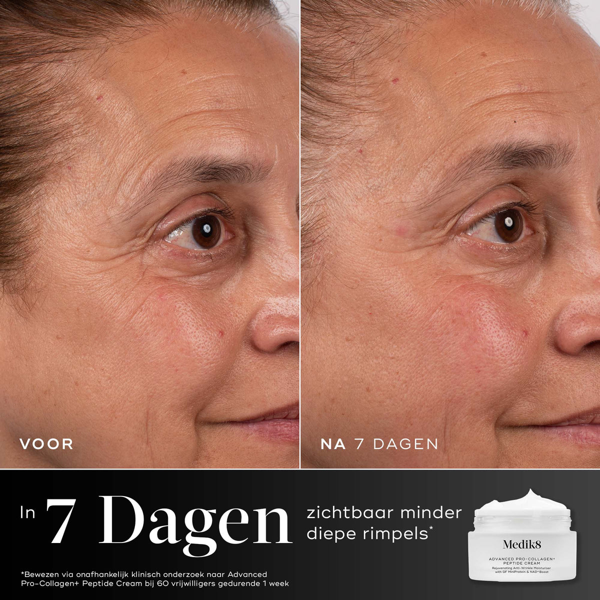 Medik8 Advanced Pro Collagen+ Peptide Cream REFILL 50ml resultado antes y después