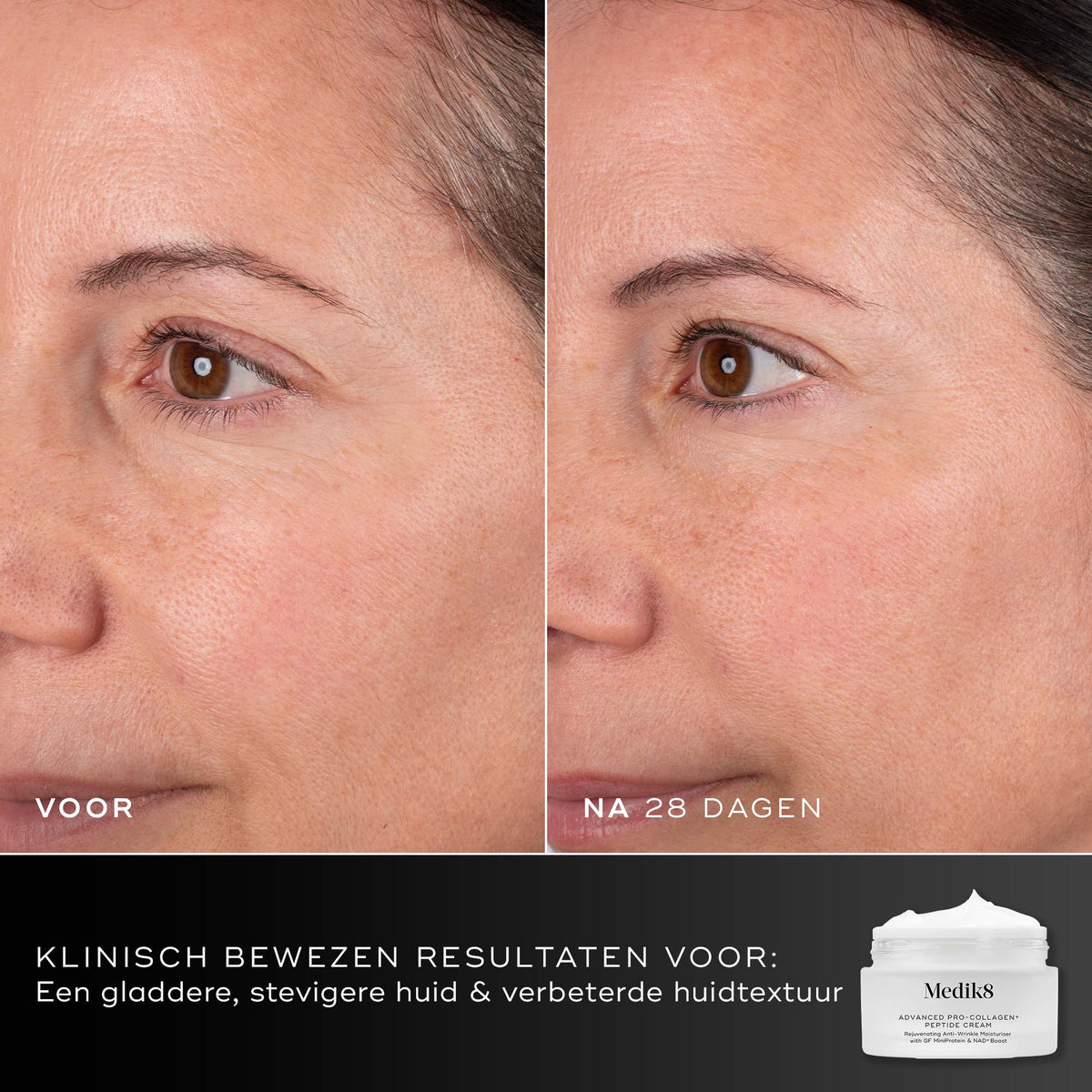 Medik8 Advanced Pro Collagen+ Peptide Cream 50ml resultado antes y después dos