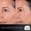 Medik8 Advanced Pro Collagen+ Refill 50ml resultado antes y después dos