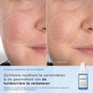 Medik8 Niacinamide peptides 30ml resultado antes y después
