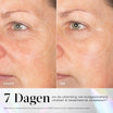 Medik8 Exo-PDRN Prismatic+ 30ml resultado antes y después dos