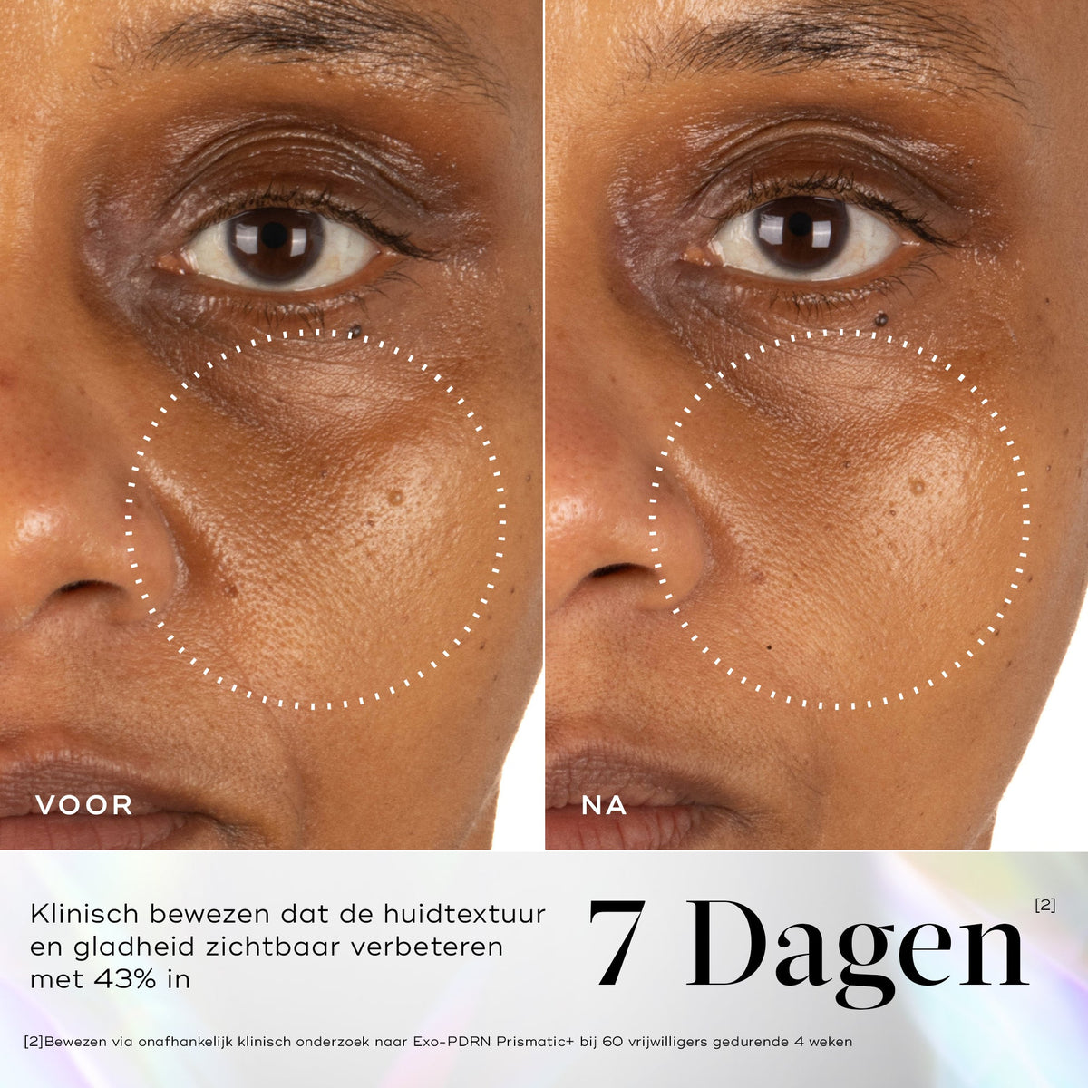 Medik8 Exo-PDRN Prismatic+ 30ml resultado antes y después tres
