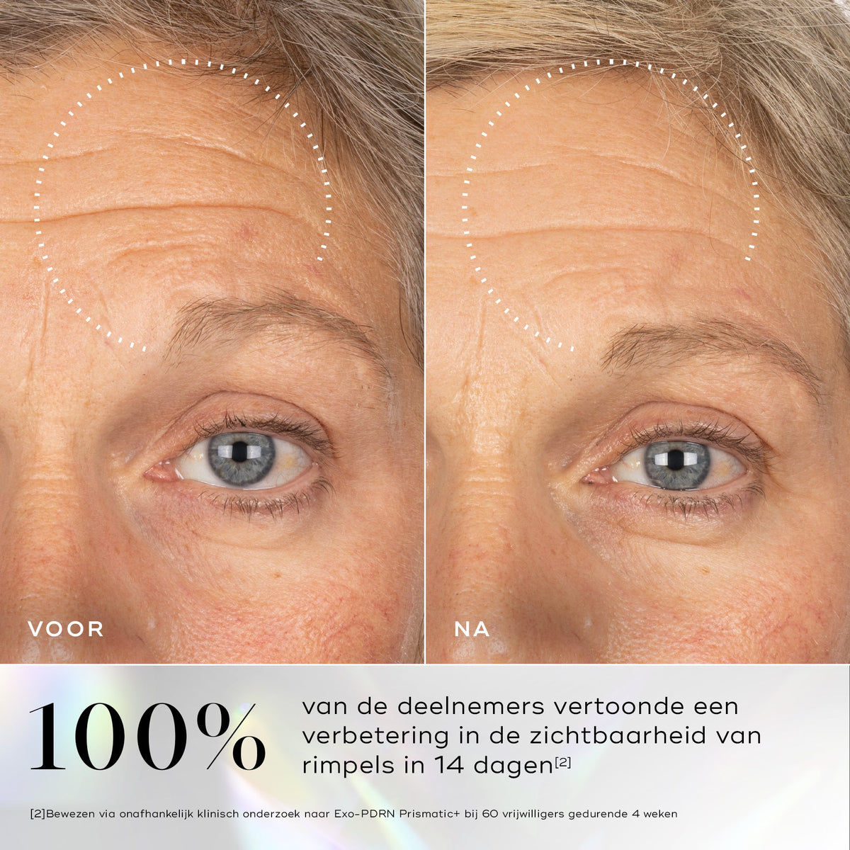 Medik8 Exo-PDRN Prismatic+ 30ml resultado antes y después