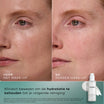 Medik8 Total Moisture Cleansing Gel 145ml resultado antes y después