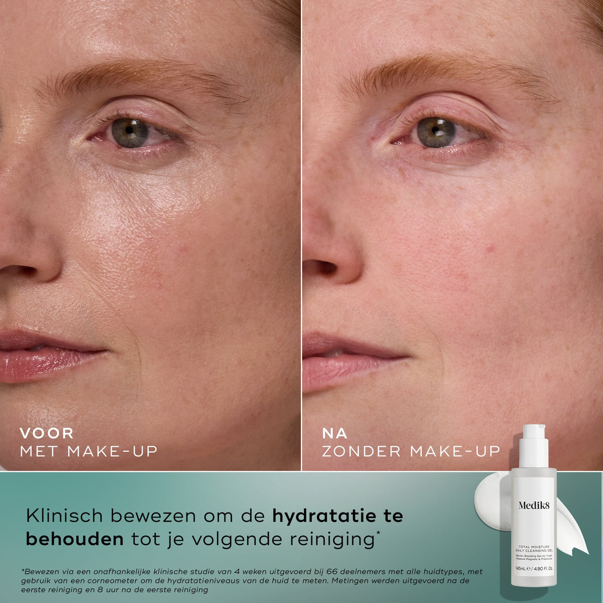 Medik8 Total Moisture Cleansing Gel 145ml resultado antes y después