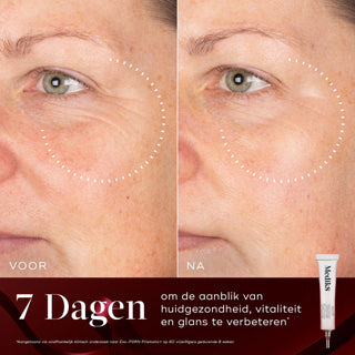 Medik8 Rejuvenation Routine Exo-PDRN Prismatic+ voor en na resultaat