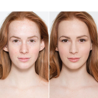 Delilah Alibi Foundation Lily before and after