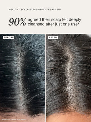 Alpha-H Healthy Scalp Exfoliating Treatment sfeer