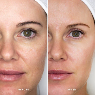 Beauty Sleep Power Peel 50ml | Alpha-H
