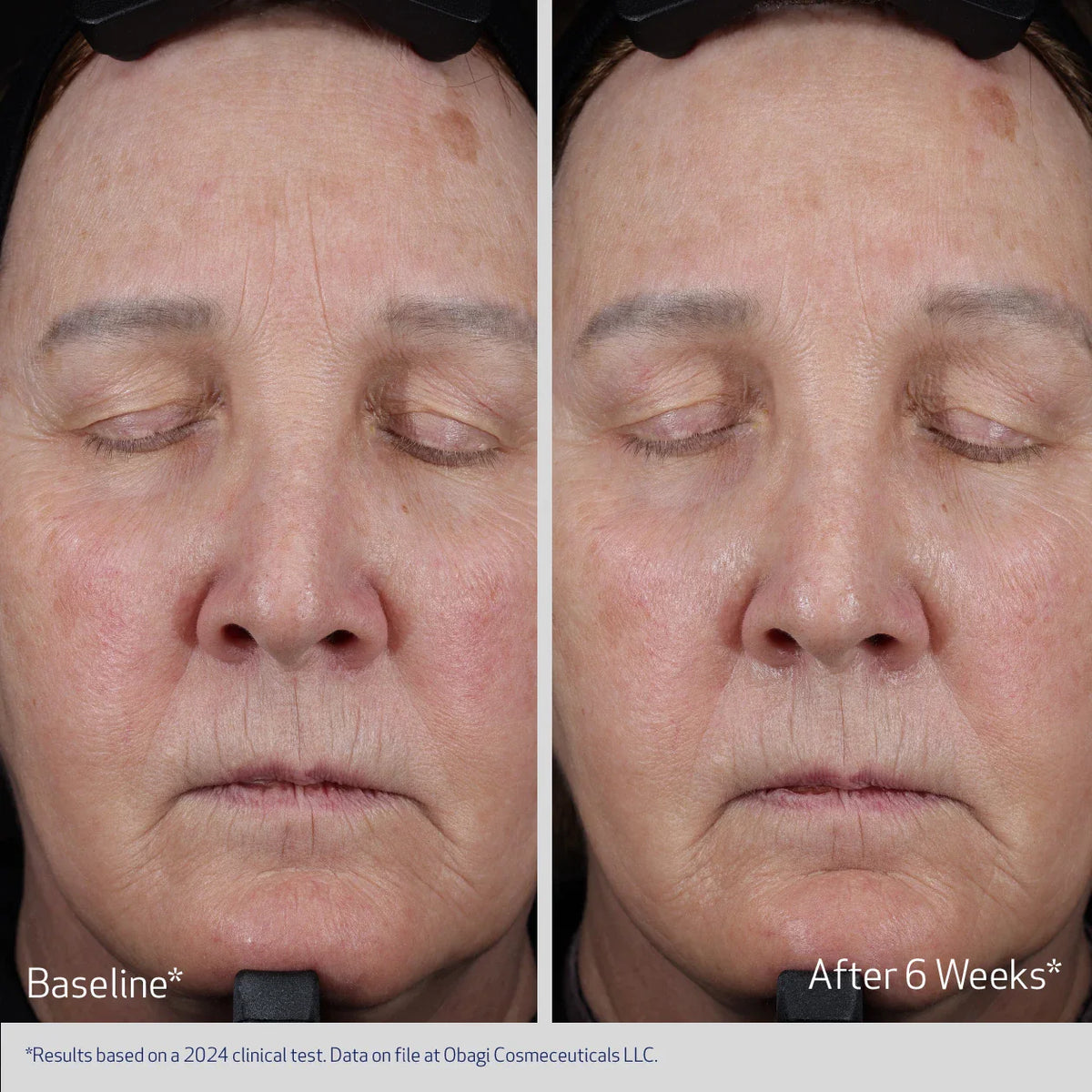 Obagi ELASTIderm Lift up & Sculpt Facial Moisturizer effect