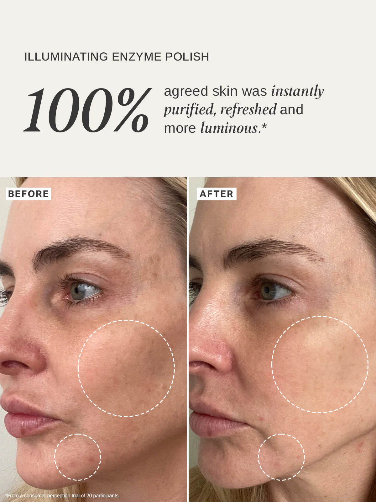 Alpha-H Illuminating Enzyme Polish antes y después