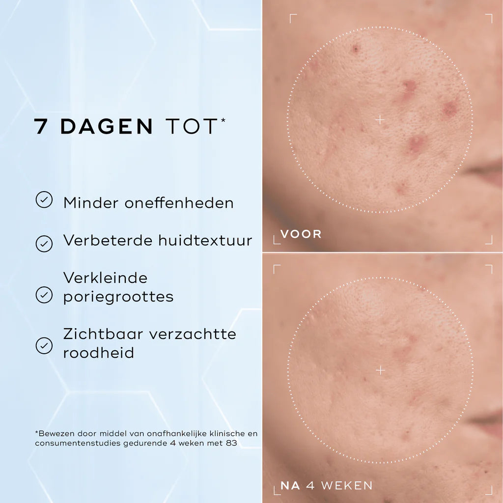 Medik8 Niacinamide peptides 30ml antes y después de 4 semanas