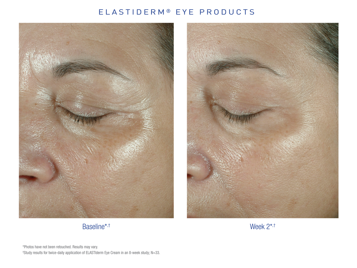 Obagi Elastiderm Eye Cream ambiente