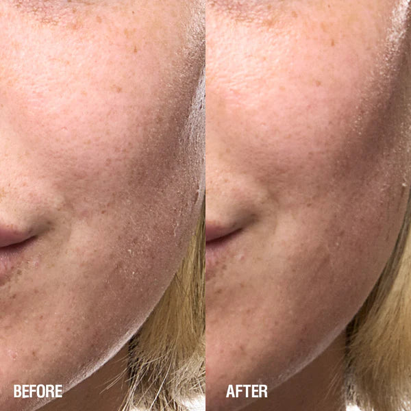 Grown Alchemist Skin Renewal Serum antes y después