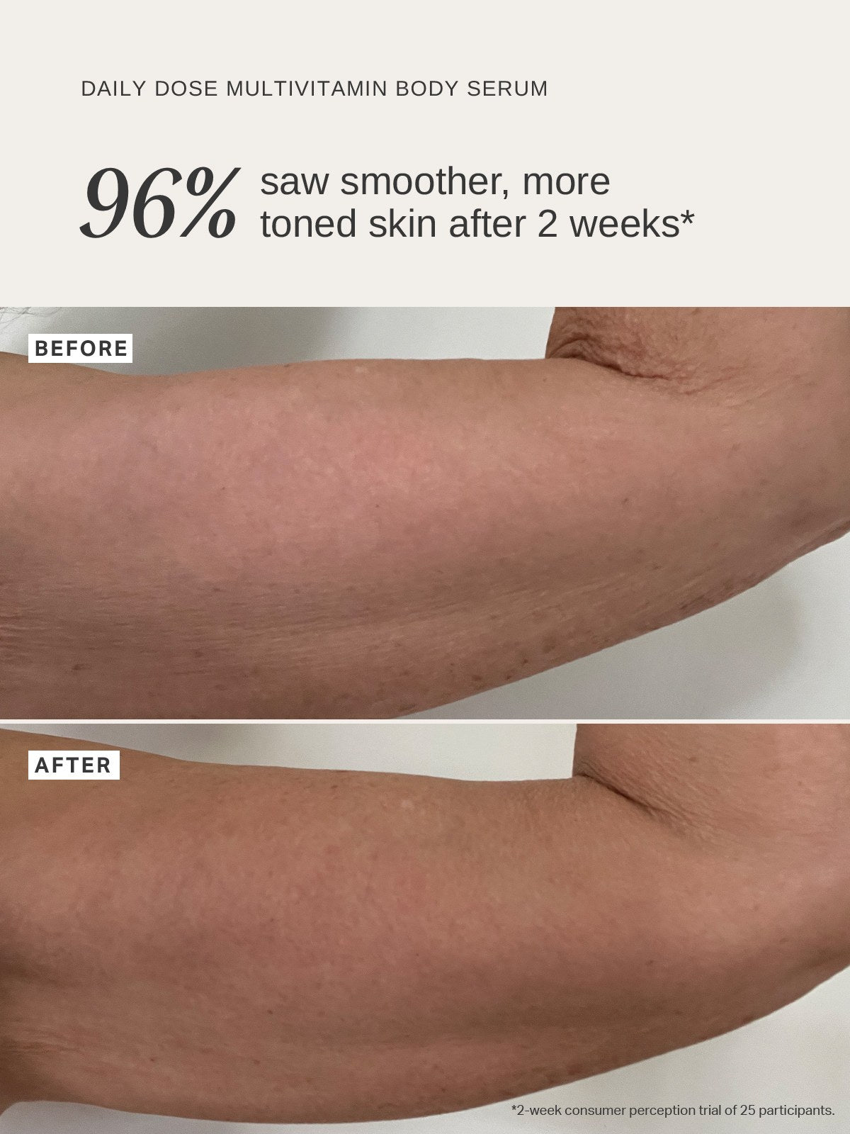 Alpha-H Daily Dose Multivitamin Body Serum brazo antes y después