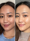 Alpha-H Liquid Gold Exfoliating Treatment antes y después resultado tres