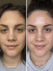 Alpha-H Liquid Gold Exfoliating Treatment antes y después resultado dos