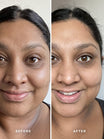 Alpha-H Liquid Gold Exfoliating Treatment antes y después resultado cuatro