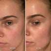 Alpha-H Midnight Reboot Serum antes y después resultado tres
