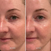 Alpha-H Midnight Reboot Serum antes y después resultado dos