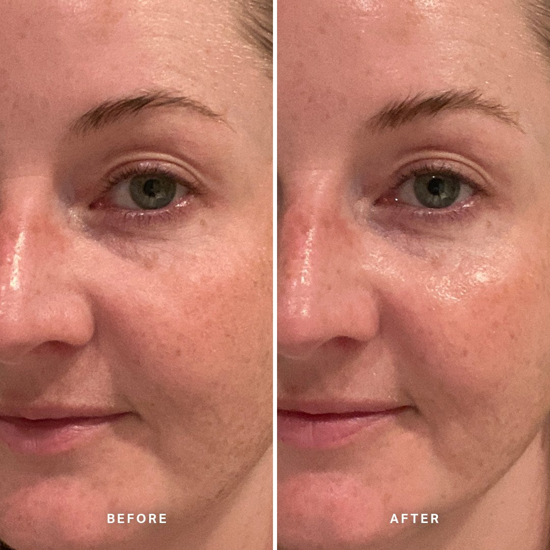 Alpha-H Midnight Reboot Serum antes y después resultado dos