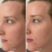 Alpha-H Midnight Reboot Serum antes y después resultado cuatro