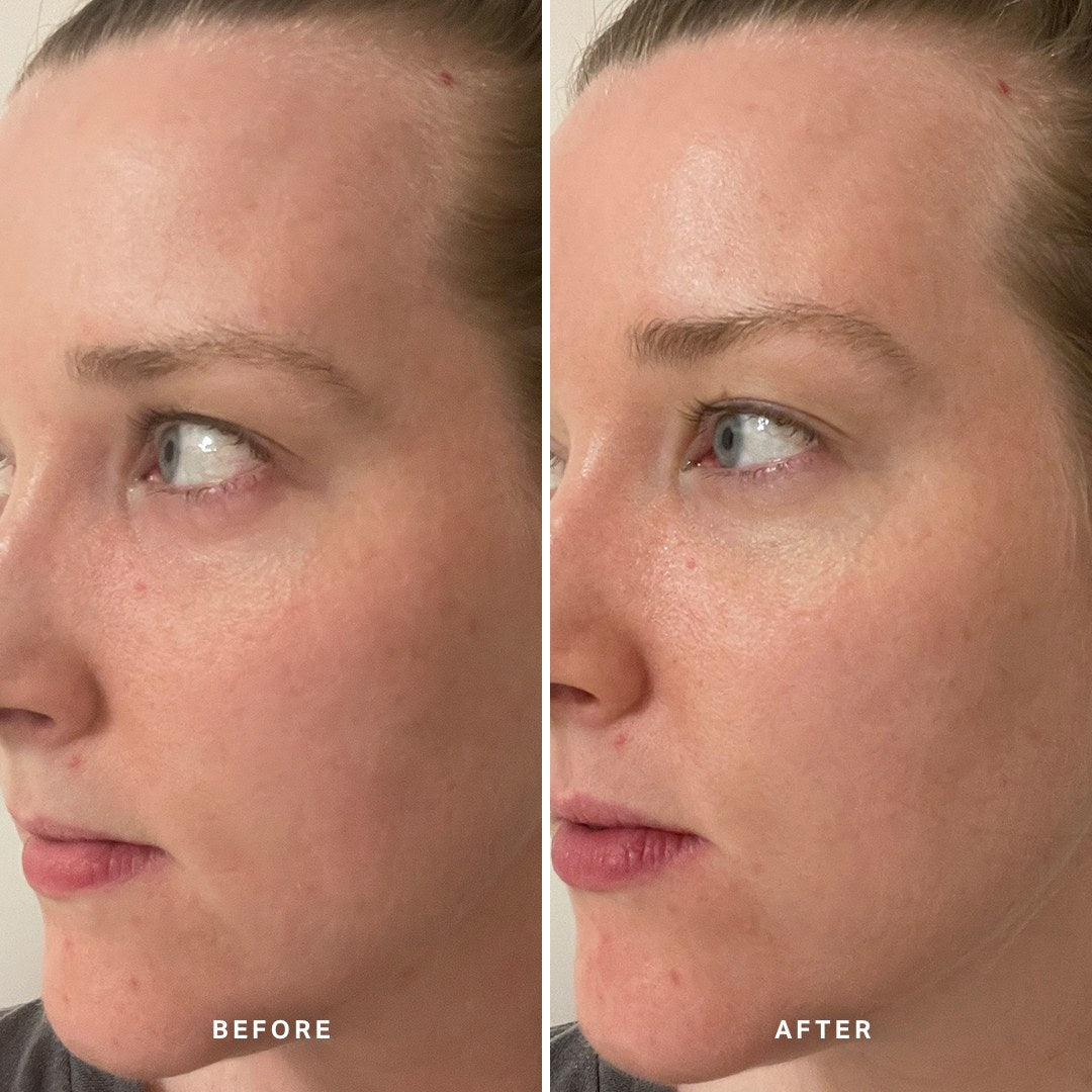 Alpha-H Midnight Reboot Serum antes y después resultado cuatro