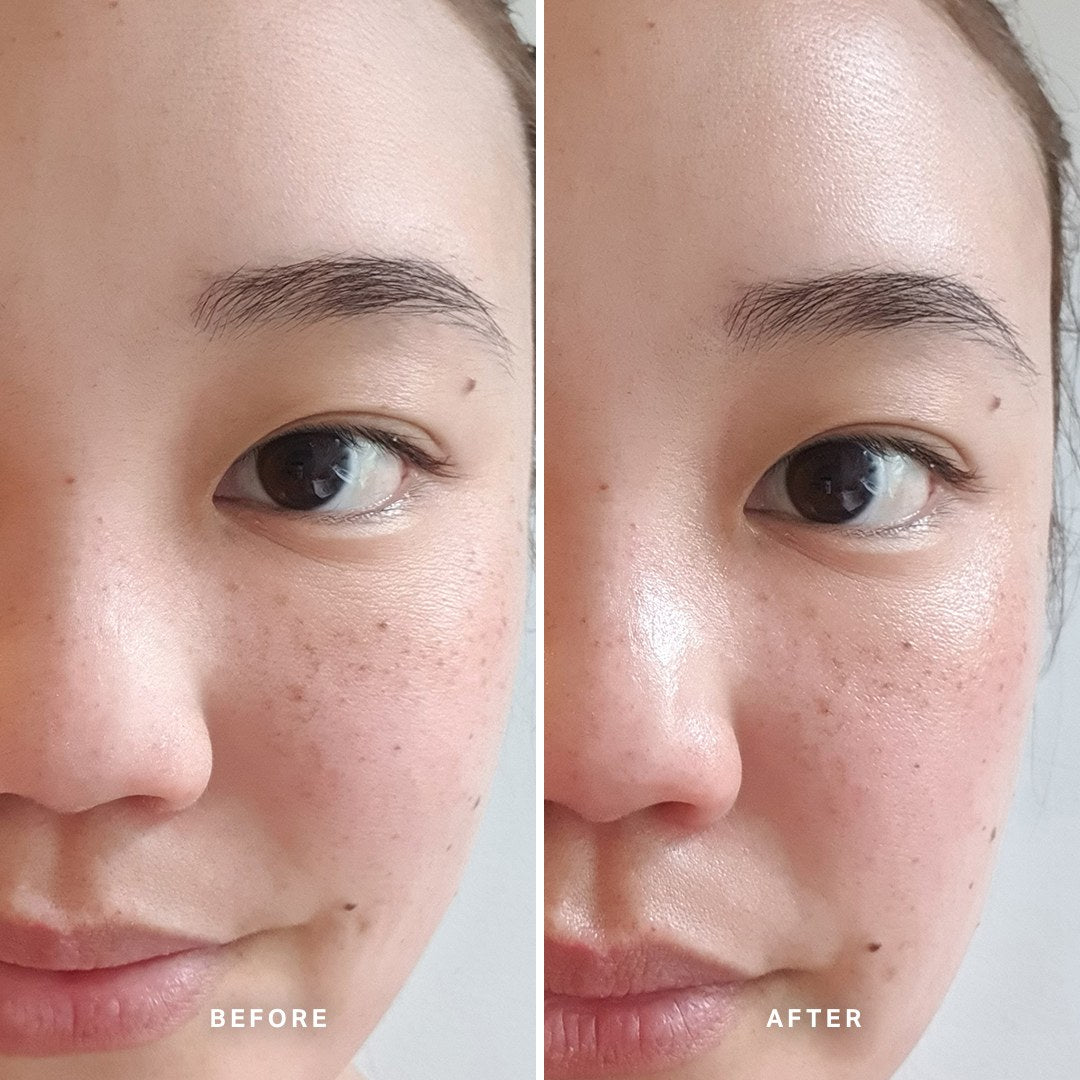 Alpha-H Midnight Reboot Serum antes y después resultado cinco