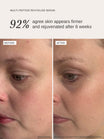 Alpha-H Multi-Peptide Revitalise Serum antes y después resultado tres
