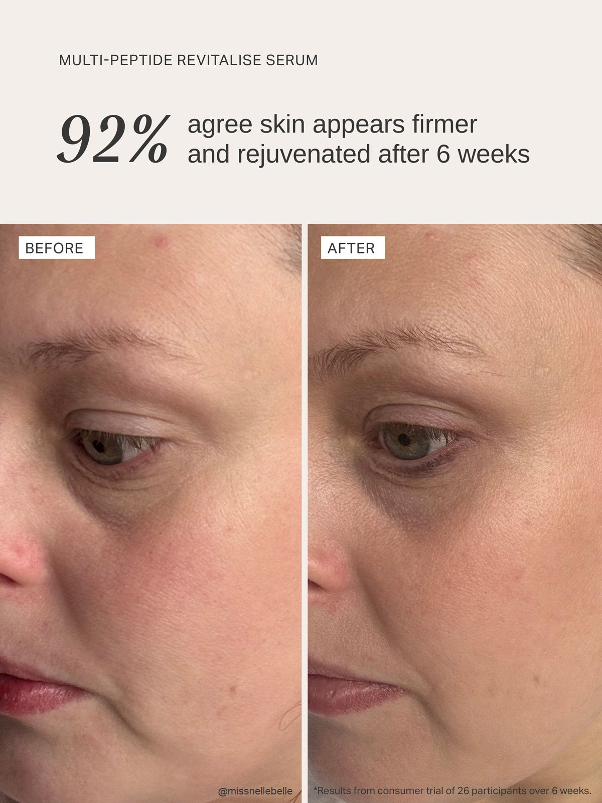Alpha-H Multi-Peptide Revitalise Serum antes y después resultado tres