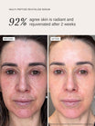 Alpha-H Multi-Peptide Revitalise Serum antes y después resultado dos