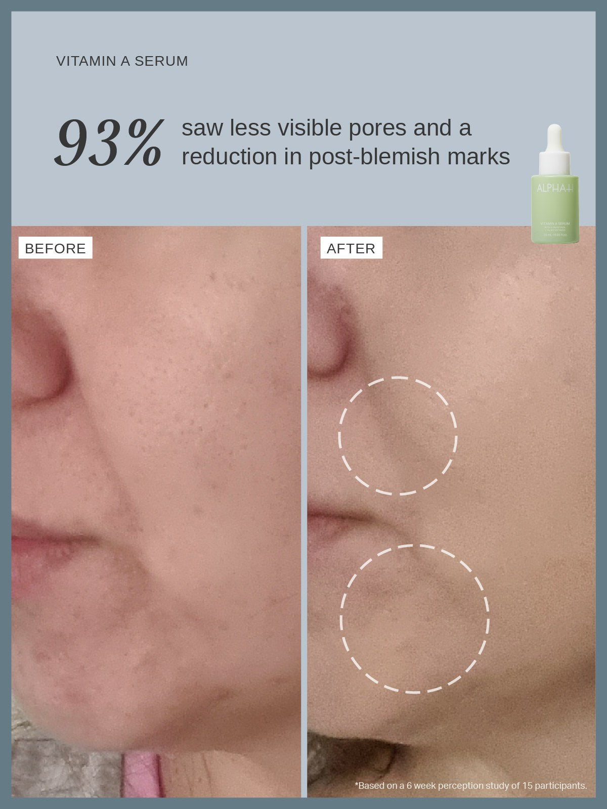 Alpha-H Vitamin A Serum antes y después poros menos visibles