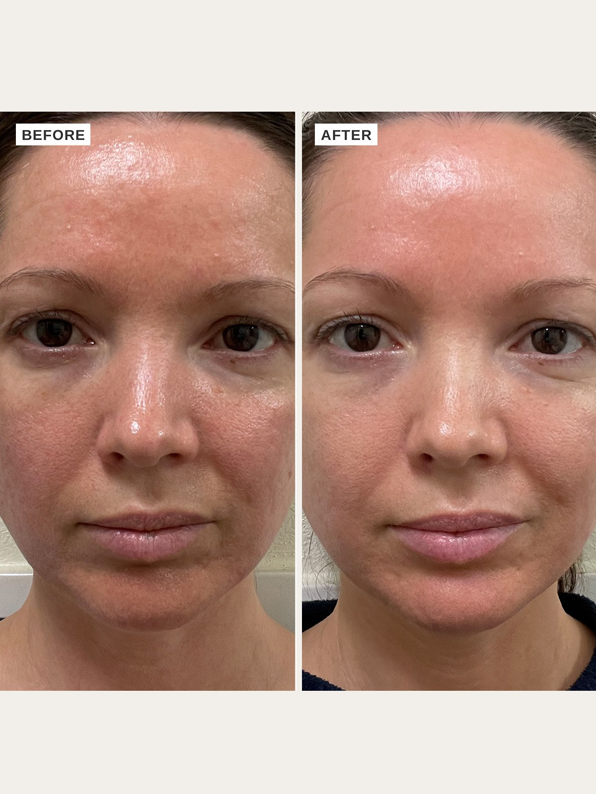 Alpha-H Vitamin B Serum antes y después resultado tres