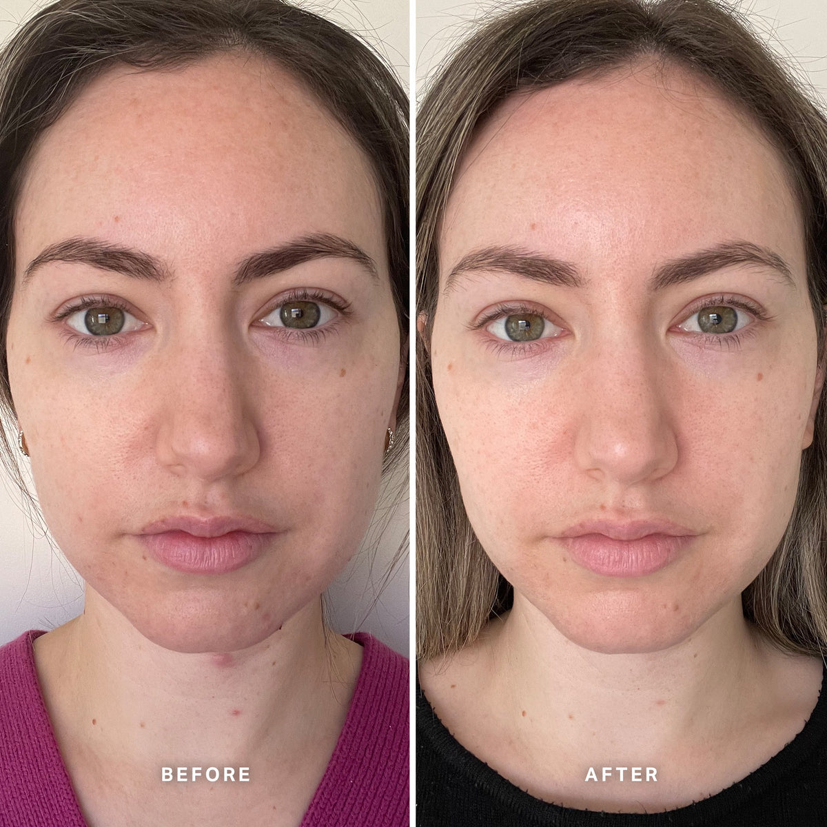 Alpha-H Vitamin B Serum antes y después resultado