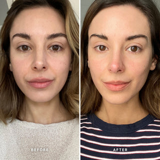 Alpha-H Vitamin C Serum antes y después resultado dos