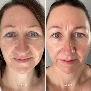 Alpha-H Vitamin E Serum antes y después resultado