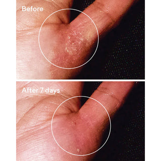 Murad Quick Relief Moisture Treatment voor en na