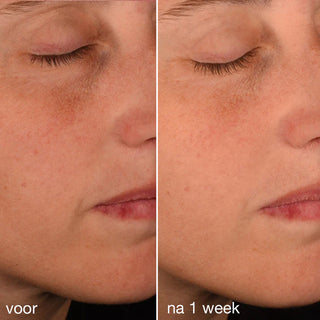 Pro-Collagen Banking Serum 30ml | Dermalogica