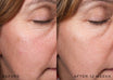 Medik8 r-Retinoate Intense - Night cream antes y después
