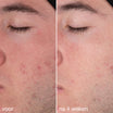 Daily Microfoliant | Dermalogica